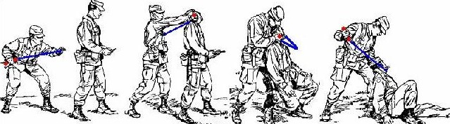 sentryremoval.jpg